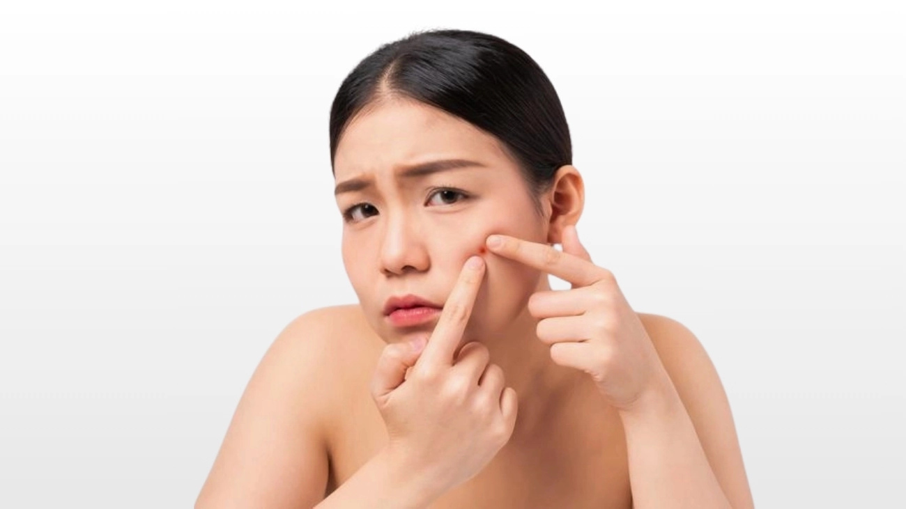 Acne treatment for teens at ATOS Medical Center