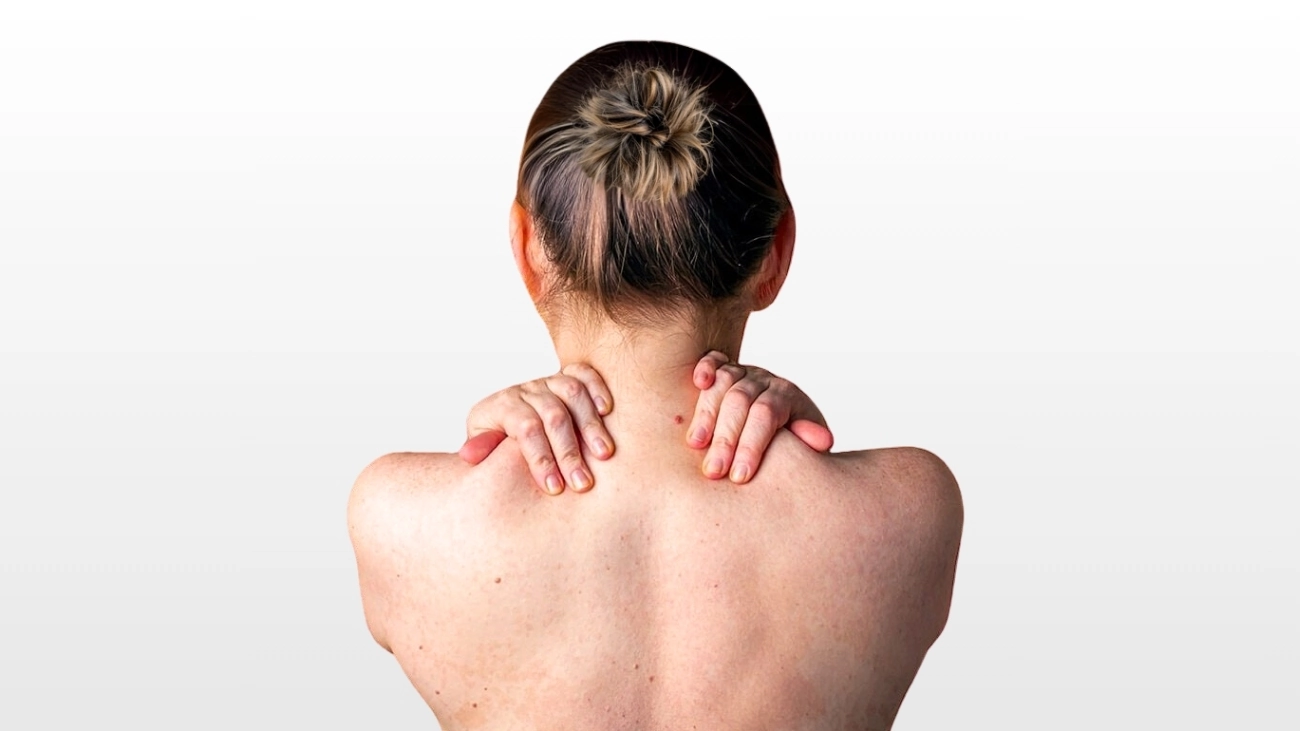 Back acne treatment service at ATOS Medical Center