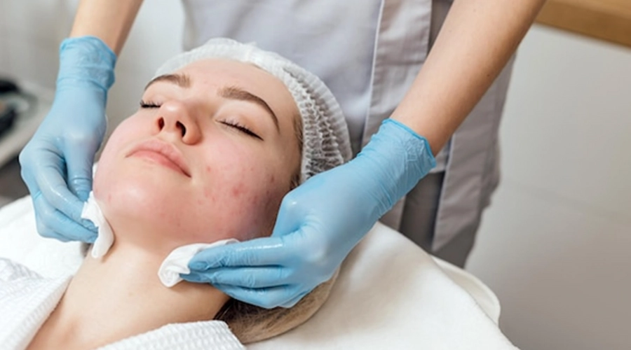 Advanced techniques for acne scar removal.