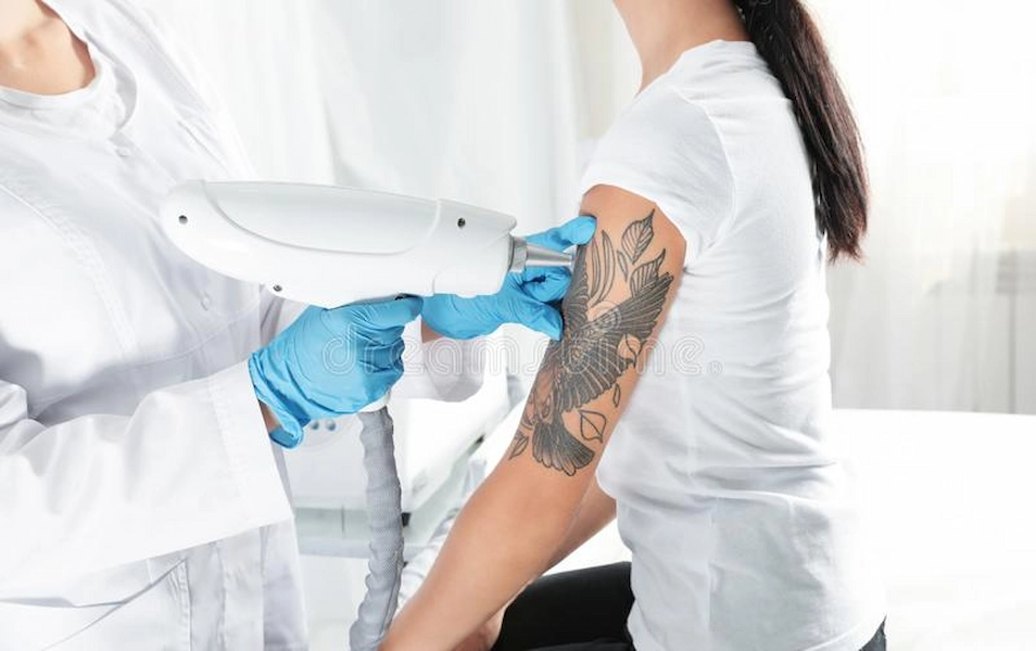 Patient receiving color tattoo removal treatment.