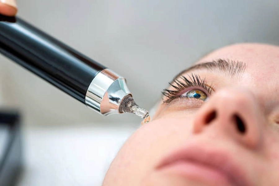 Patient receiving plasma skin resurfacing treatment.