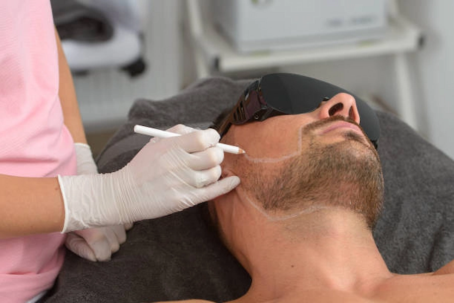 Man receiving laser hair removal treatment.