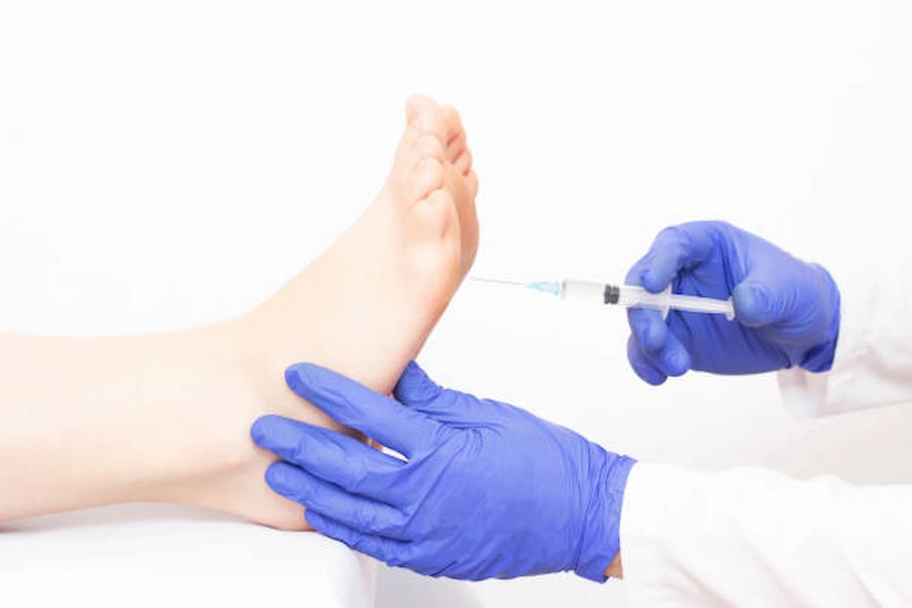 Patient receiving Botox for foot sweating relief.