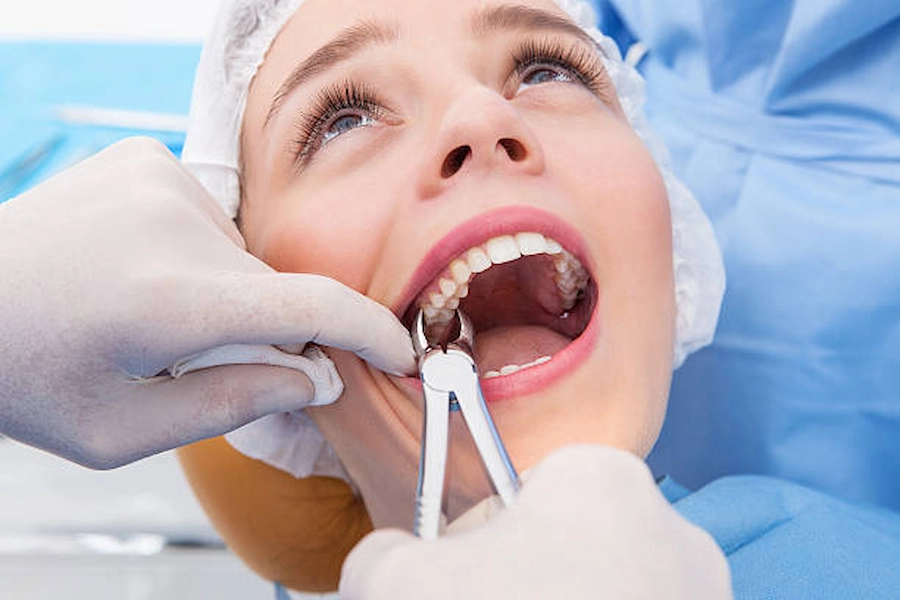 Emergency dental care in Qatar for tooth extraction