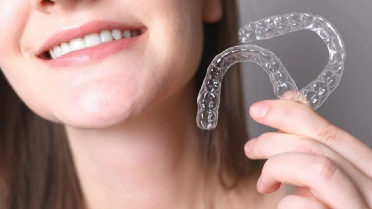 Innovative orthodontic solution: clear bracket braces.