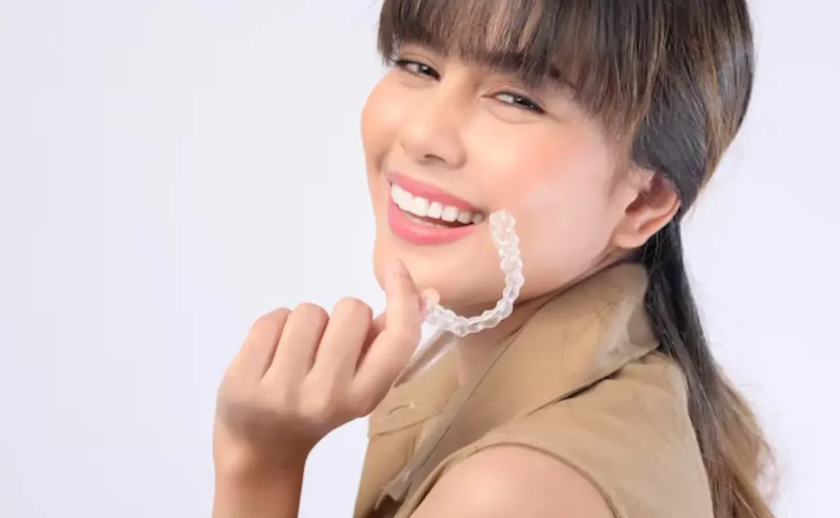 Hidden braces service for a confident smile