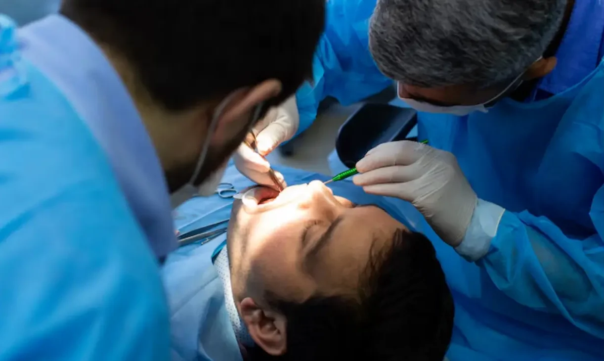 جراحة ضرس العقل المدفون في قطر